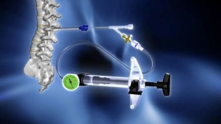 Dragon Crown Medical Strumenti ortopedici per la chirurgia mininvasiva della colonna vertebrale